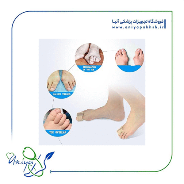 فاصله دهنده سیلیکونی پارچه ای 2