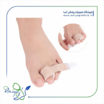 بانداژ پارچه ای انگشتان چکشی 2